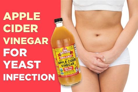 apple cider vinegar for vaginal yeast infection and oral thrush 2017 guide