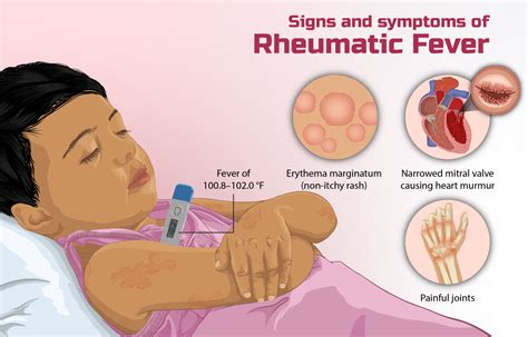rheumatic fever      storymd