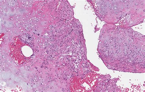 pathology outlines who classification