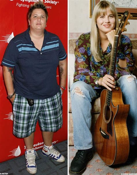 chastity chaz bono before and after surgery bono