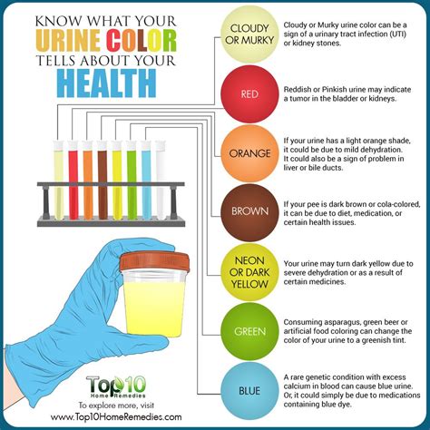 Know What Your Urine Color Tells About Your Health Top