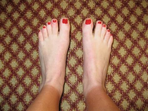 20 Hilarious Tan Lines Thatll Make You Never Want To Step Outside Again