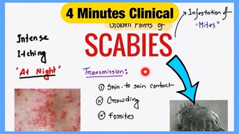 scabies spot diagnosis and prescription symptoms pathogenesis