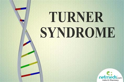 turner syndrome causes symptoms and treatment netmeds