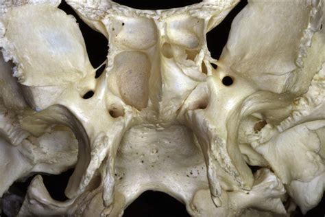 Anterior Inferior View Of Skull Base Neuroanatomy The Neurosurgical