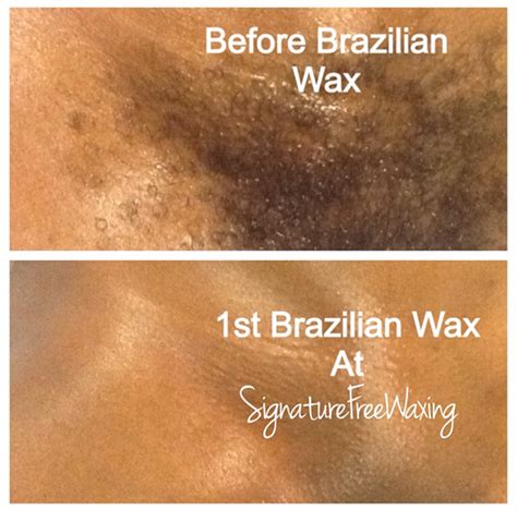 Best Brazilian Wax Chicago Skye Handy