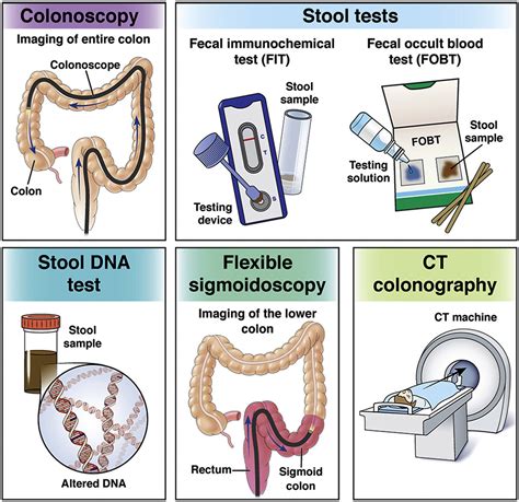 Demand For Colonoscopy In Colorectal Cancer Screening Using A Hot Sex