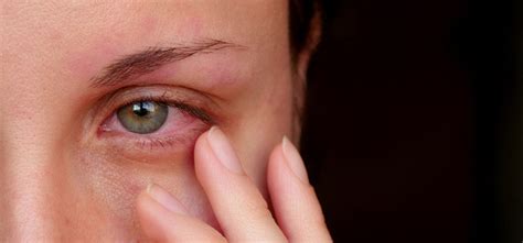 common eye infections  adults silverstein eye centers