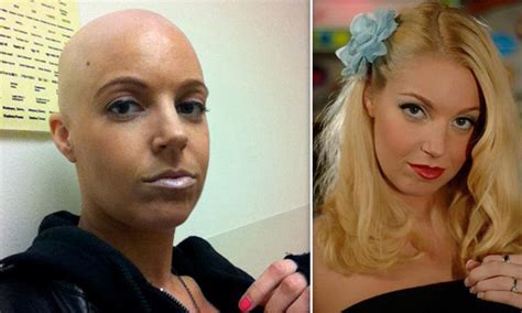 hollie stevens bald headed porn star battling cancer at age 30 daily mail online