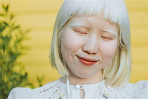 Cute Albino Girl Listening Her Premium Photo Rawpixel