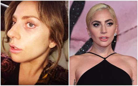 17 Celebrities Without Makeup Before And After Grazia