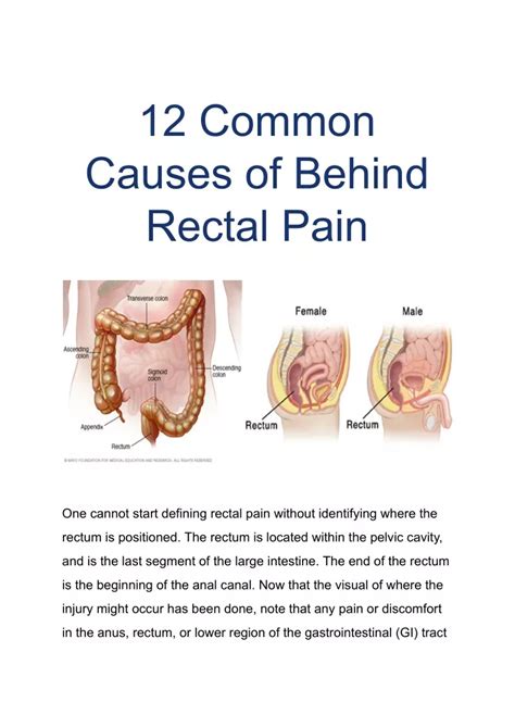 Ppt 12 Common Causes Of Behind Rectal Pain Powerpoint Presentation