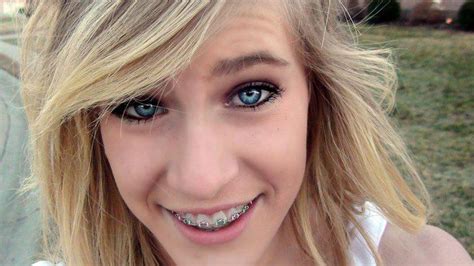 girls with braces on twitter braces blue eyes braces