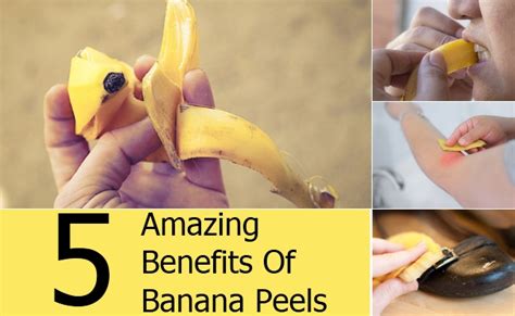5 Amazing Benefits Of Banana Peels Find Home Remedy