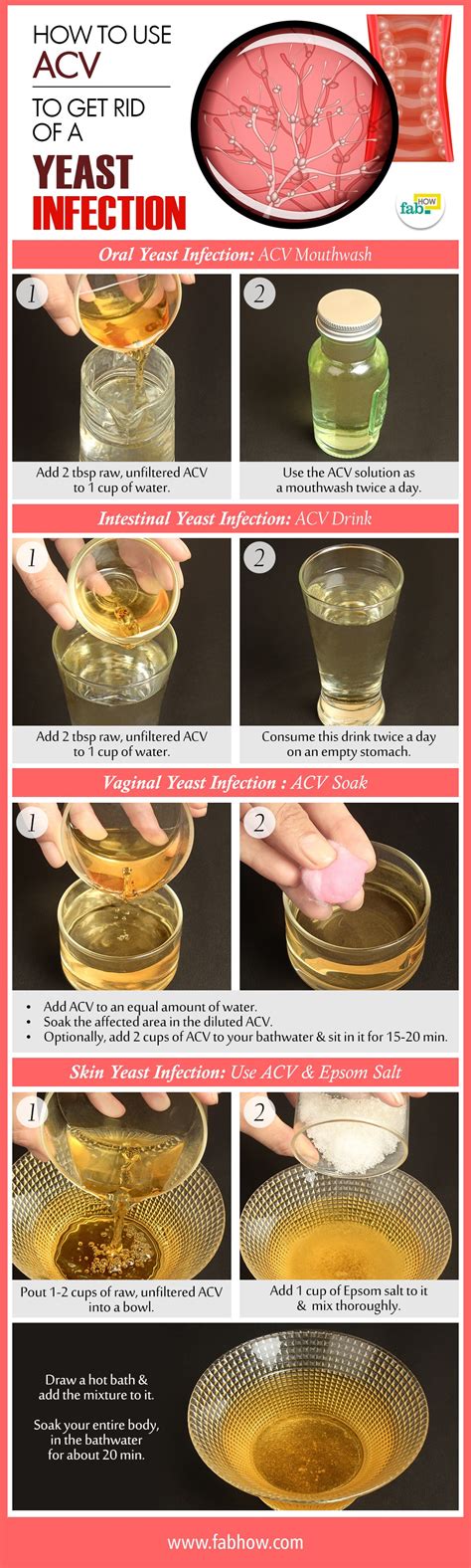 apple cider vinegar   rid   yeast infection