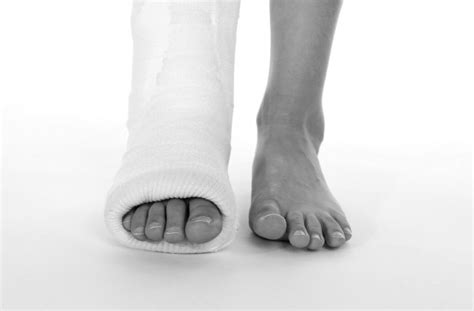 broken foot healthvibe