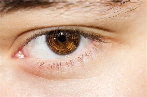 diagnose puffy eyelids  wont   healthfully