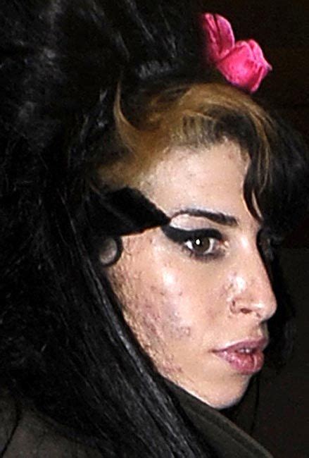amy winehouse s lifestyle is taking its toll for her once fresh faced