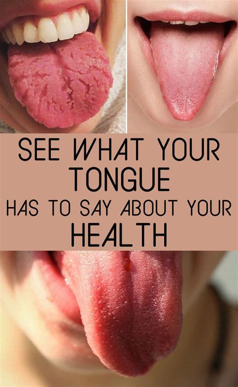 tongue      health healthiousnet