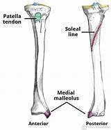 Tibia Shaft Tibial Distal Proximal Anatomy Fibula Labeled Teachmeanatomy Landmarks Bony Spine sketch template