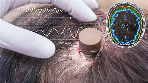 science  elon musks neuralink brain chip currents wired