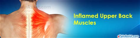 inflamed upper  muscles treatment  symptoms