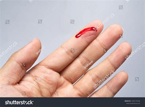 bleeding blood   cut finger wound royalty  stock photo  avopixcom