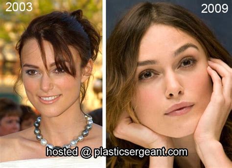 17 best images about plastic surgery before and after