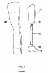 Prosthetic Prothesis Patents Drawing Limb Prosthesis Patent Paper Patenten Afbeeldingen sketch template