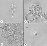 Fusarium Oxysporum Nonpathogenic Characteristics Morphological Isolates Chlamydospores sketch template