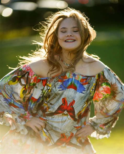 down s syndrome model inspiring girl on a road to