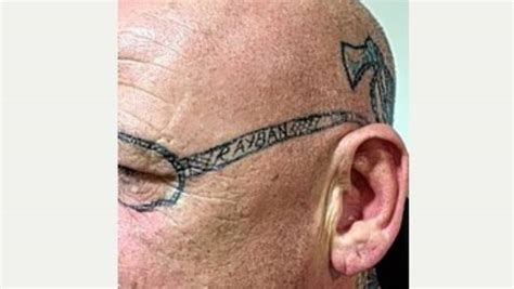 man needs laser surgery to remove sunglasses tattooed on
