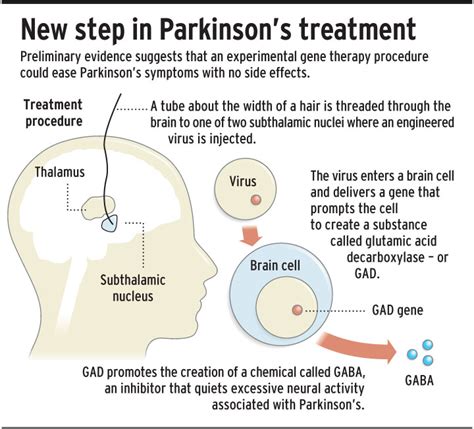 Gene Therapy Shows Promise For Easing Parkinson’s Disease News