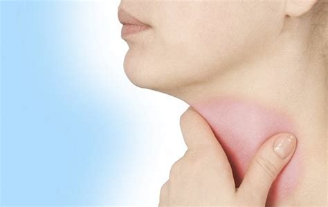 strep throat all you need to know westside head and neck