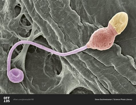 magnification view of a deformed sperm cell under a color scanning