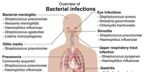 overview   bacterial infections chart nclex quiz