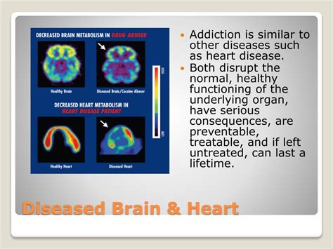ppt the biology of addiction powerpoint presentation