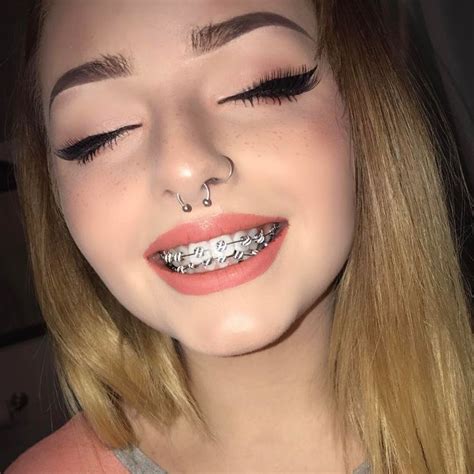 braquets braquets pinterest brakets brackets