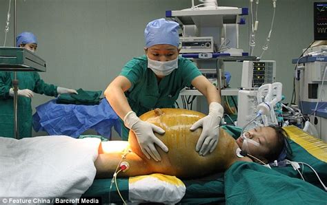 Chinese Girl Successfully Undergoes Surgery To Remove 33 Pound Tumour