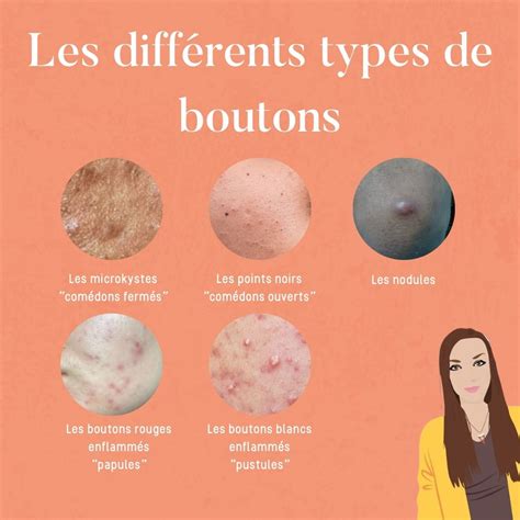 acne les differents types de boutons  good balance