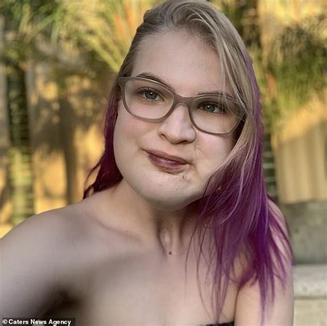 teenager 18 with facial tumour reveals strangers assume she s just