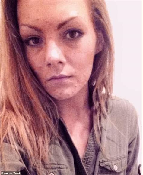 incredible before and after pictures show how pock marked meth addict