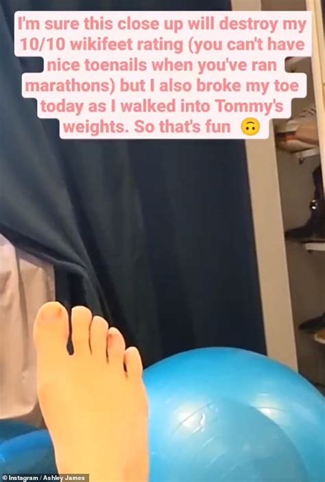 pregnant ashley james reveals she broke her toe by walking