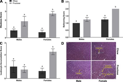 Sex Modifies The Consequences Of Extended Fructose Consumption On Liver