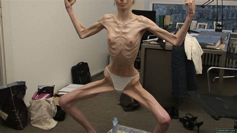anorexic porn thread nws page 16 yellow bullet forums