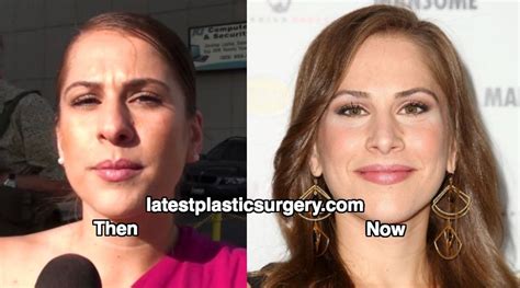 ana kasparian nose job plastic surgery rumors true or false latest plastic surgery gossip
