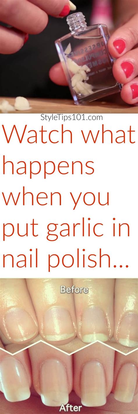 extreme nail growth   add crushed garlic  clear nail