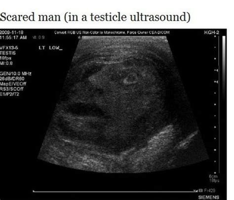 uncanny ultrasound pictures 14 pics
