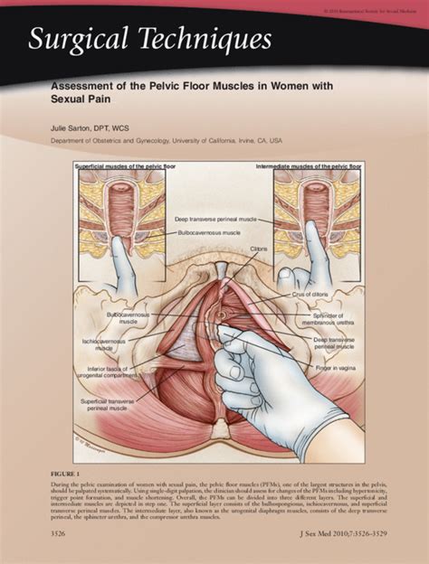 Learn How To Perform A Pelvic Floor Muscular Exam