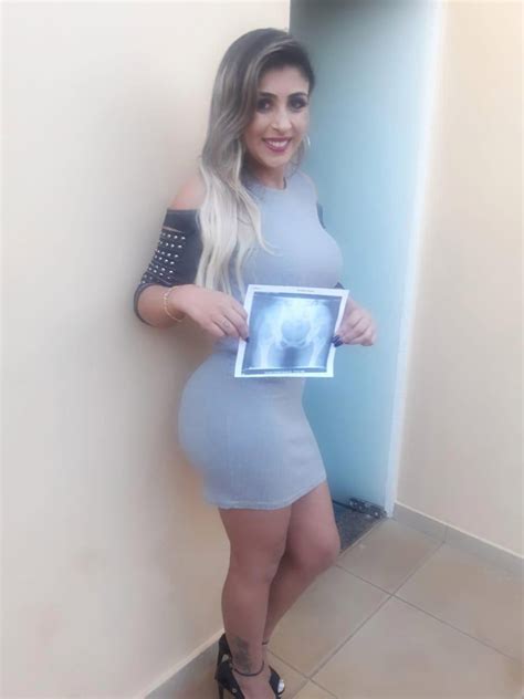 Miss Bumbum Contestants Pose With X Rays Of Their Massive
